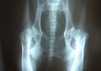 arthritis röntgen